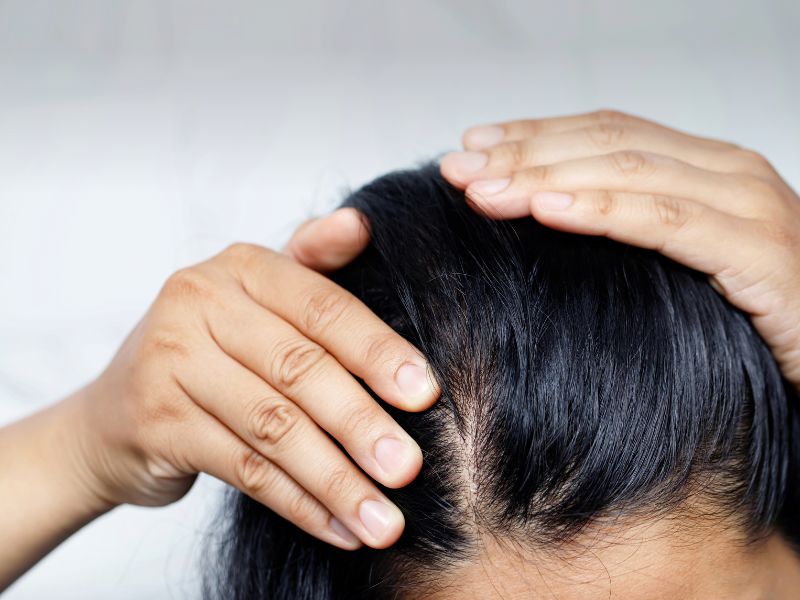 Woman Experiencing Hair Loss and dry hair