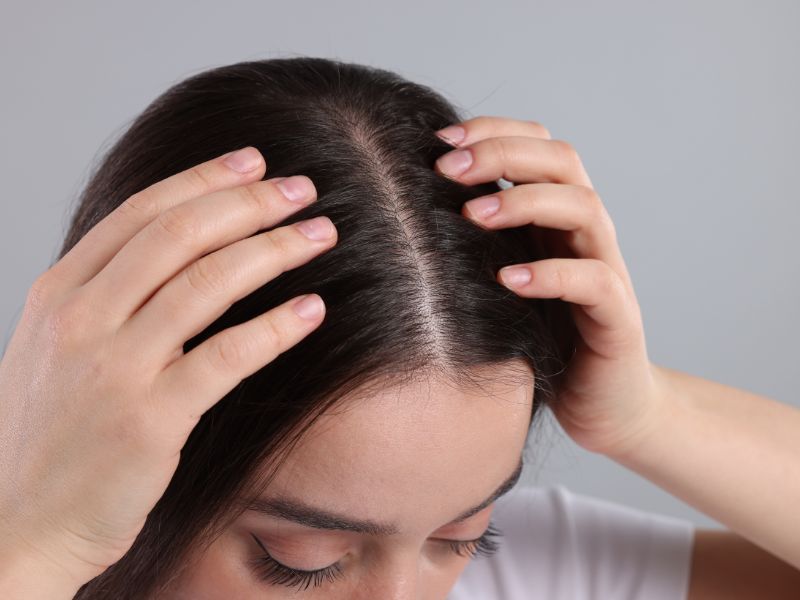 A woman with healthy scalp